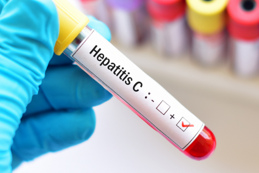 Найти панацею: почему гепатит еще остается опасным заболеванием